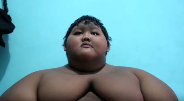 Najgojaznije dete na svetu: Desetogodišnjak sa 192 kg